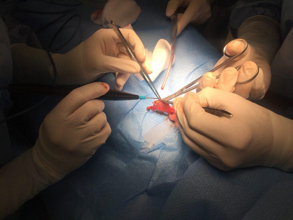 Surgery